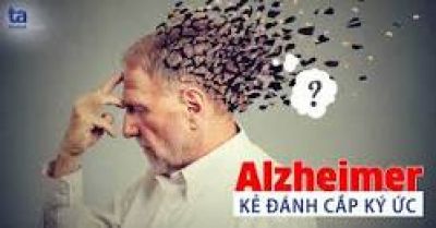 5 điều giúp ngăn ngừa chứng mất trí nhớ và bệnh Alzheimer