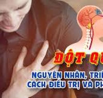 Bác sĩ lý giải nguyên nhân đàn ông dễ đột quỵ ở tuổi 49-53