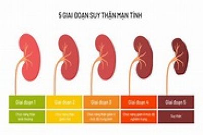 Suy thận: Chuy&ecirc;n gia chỉ ra c&aacute;c triệu chứng sớm