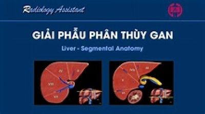 Thuốc bổ' hại gan