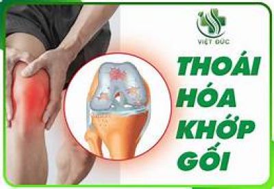 Đi bộ nhiều c&oacute; l&agrave;m khớp gối m&ograve;n nhanh hơn?