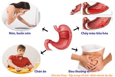 5 thói quen làm hại dạ dày của bạn
