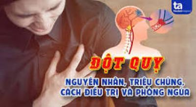 Tiếp nhận h&agrave;ng chục ca đột quỵ mỗi ng&agrave;y, b&aacute;c sĩ cảnh b&aacute;o 3 yếu tố nguy hiểm