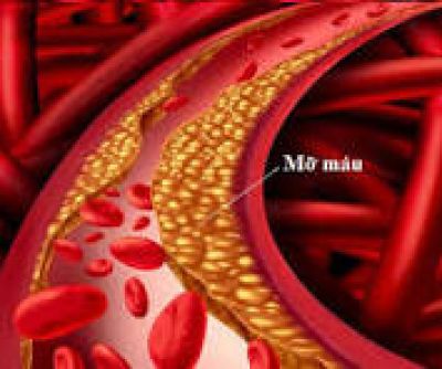Chế độ ăn phòng tăng mỡ máu ở người cao tuổi