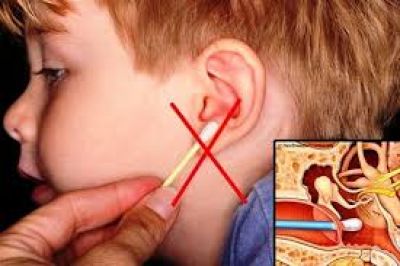 Ráy tai đóng khối khiến bé trai nghe kém