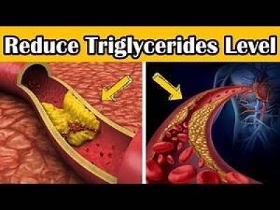 Nguy kịch v&igrave; bỏ qua chỉ số x&eacute;t nghiệm triglyceride trong m&aacute;u