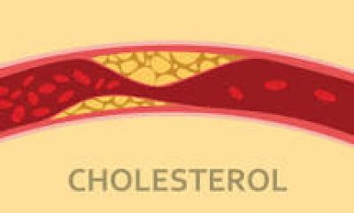 Chuyên gia: 7 loại thực phẩm hàng đầu giúp giảm cholesterol, ngăn ngừa bệnh tim